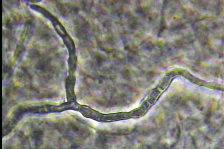 白癬菌（水虫）の位相差顕微鏡画像